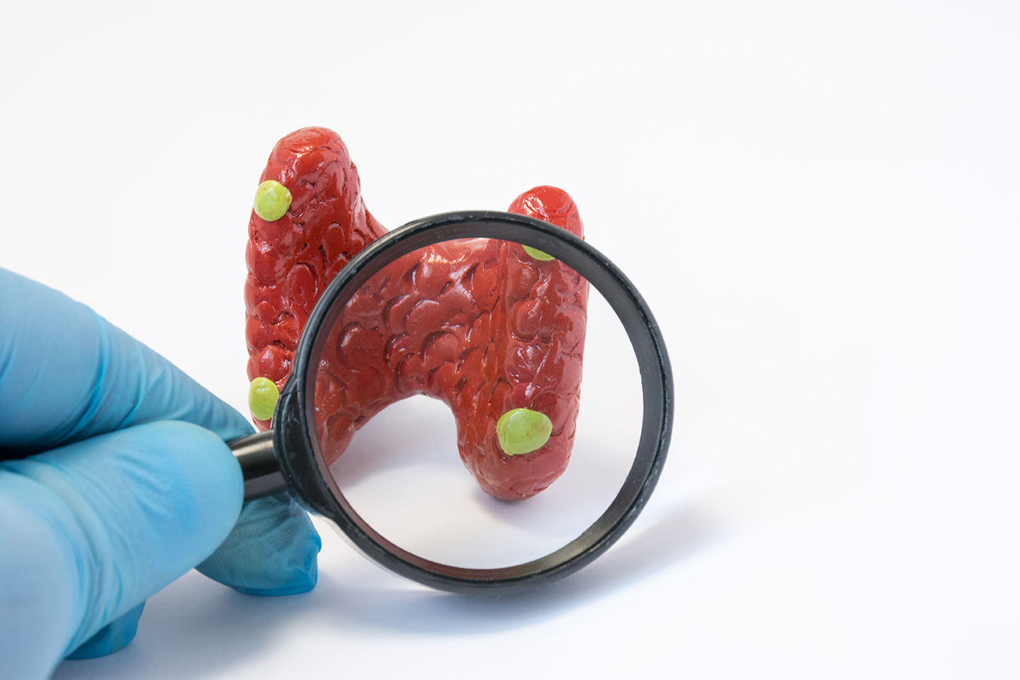 Parathyroid Disorders