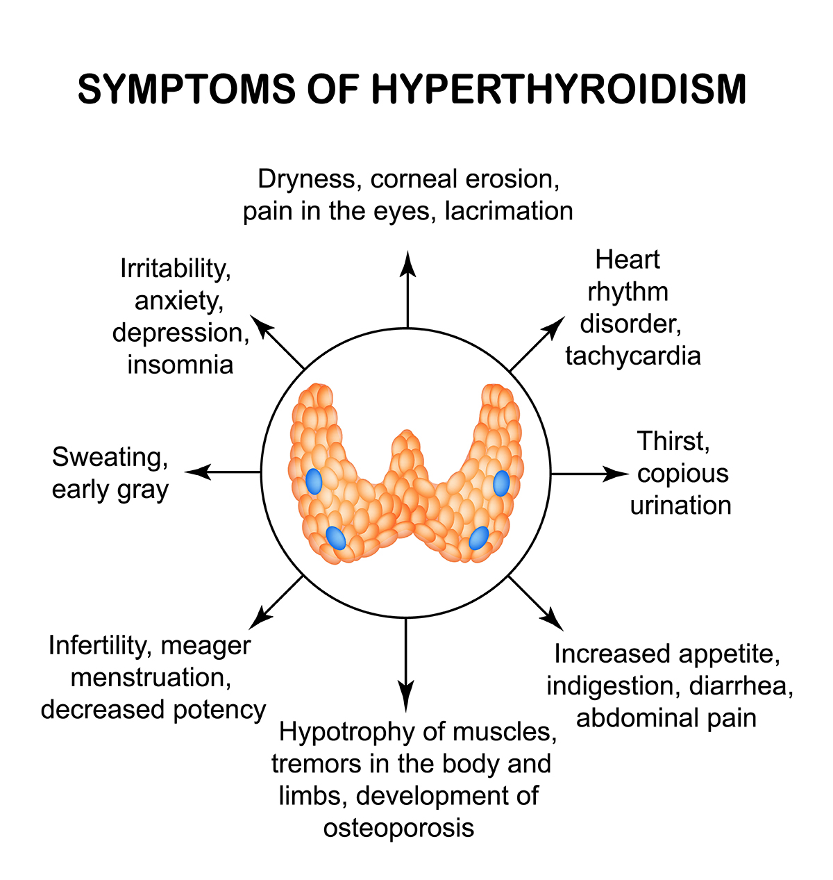 Signs & Symptoms of Hyperthyroidism