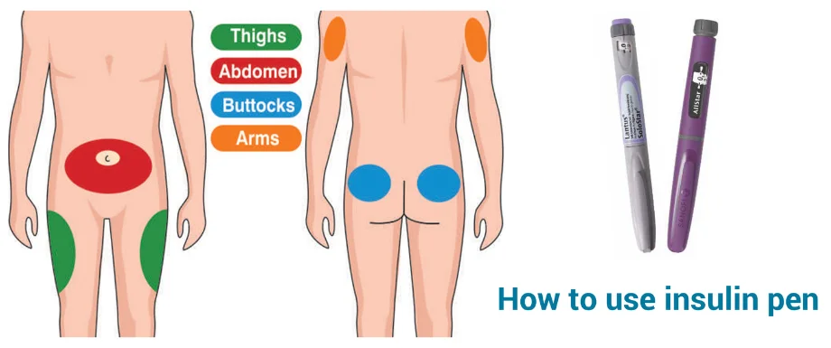 How to use an insulin pen?