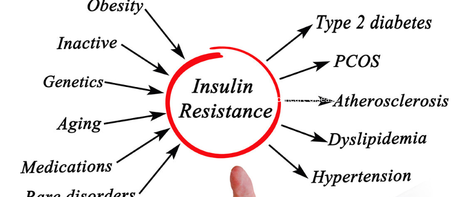 Insulin Resistance and symptoms of type 2 diabetes