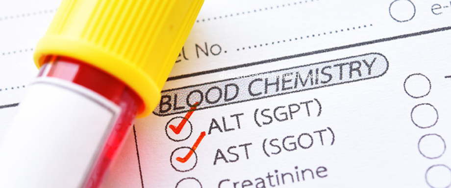 Liver Tests in Diabetes