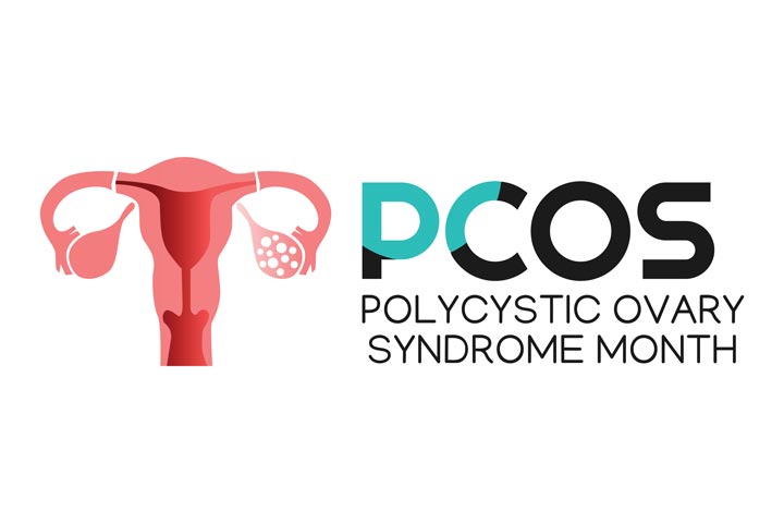 PCOS