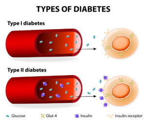 Type 1 and Type 2 diabetes