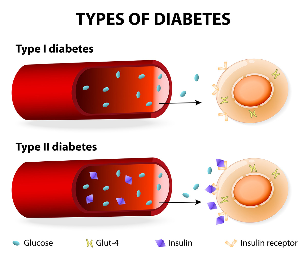 Type 1 and Type 2 diabetes