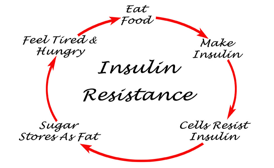Insulin Resistance & obesity