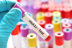 Test tube with HbA1c test written on it