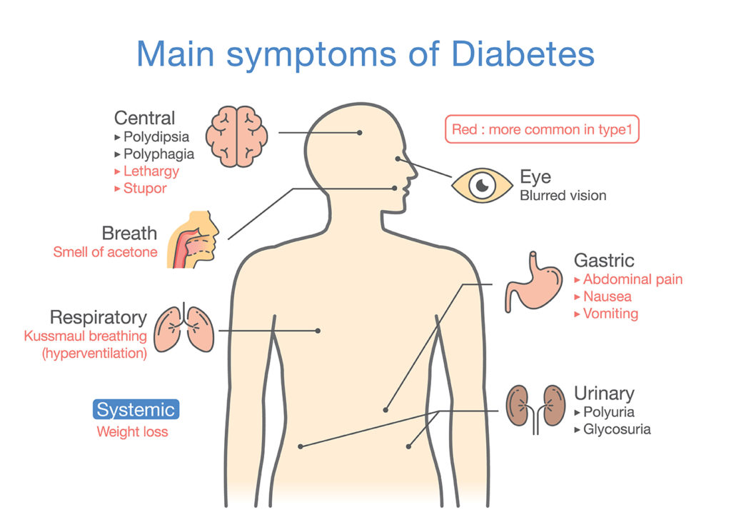 diabetes symptoms type 2 early konzervatív kezelése 2 típusú diabetes mellitus