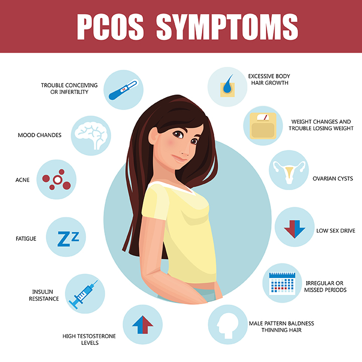 What are the symptoms of PCOS? Apollo Sugar Clinics