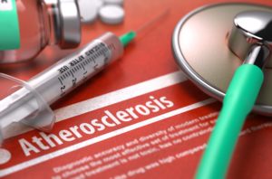 Atherosclerosis diagnosis