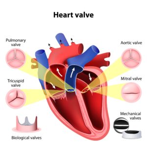 Heart valve disease symptoms