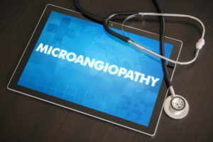 Microangiopathy Symptoms