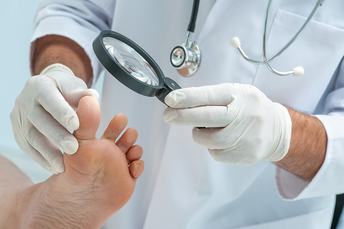 Diagnosis of diabetic foot ulcer