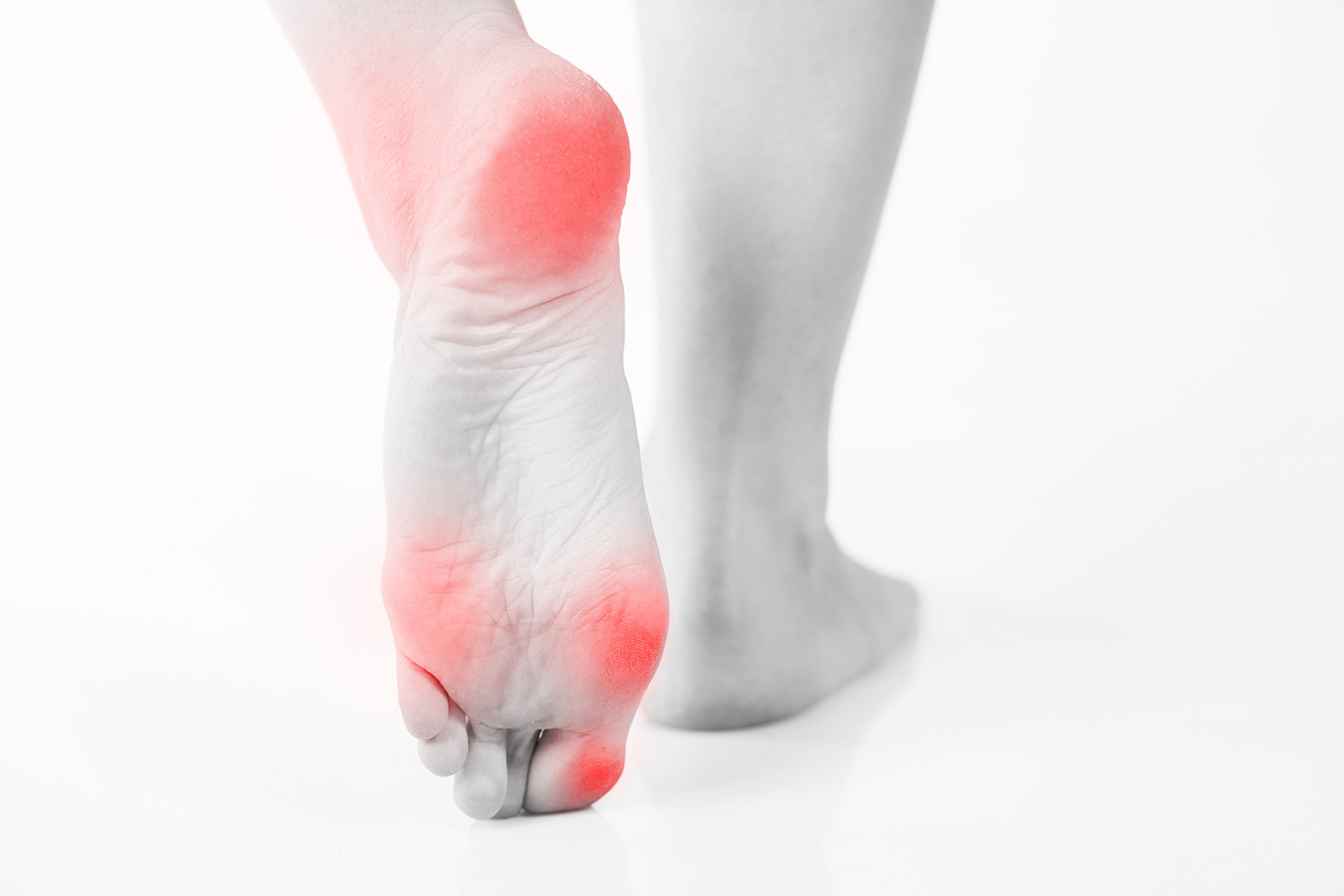Symptoms of foot calluses in diabetes