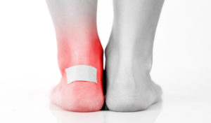 Symptoms of diabetic foot blisters