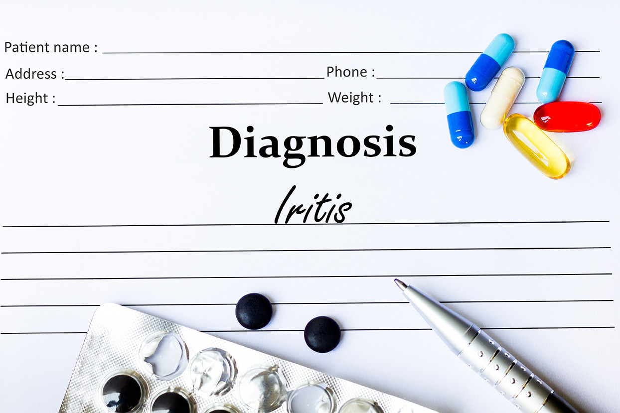 Iritis diagnosis