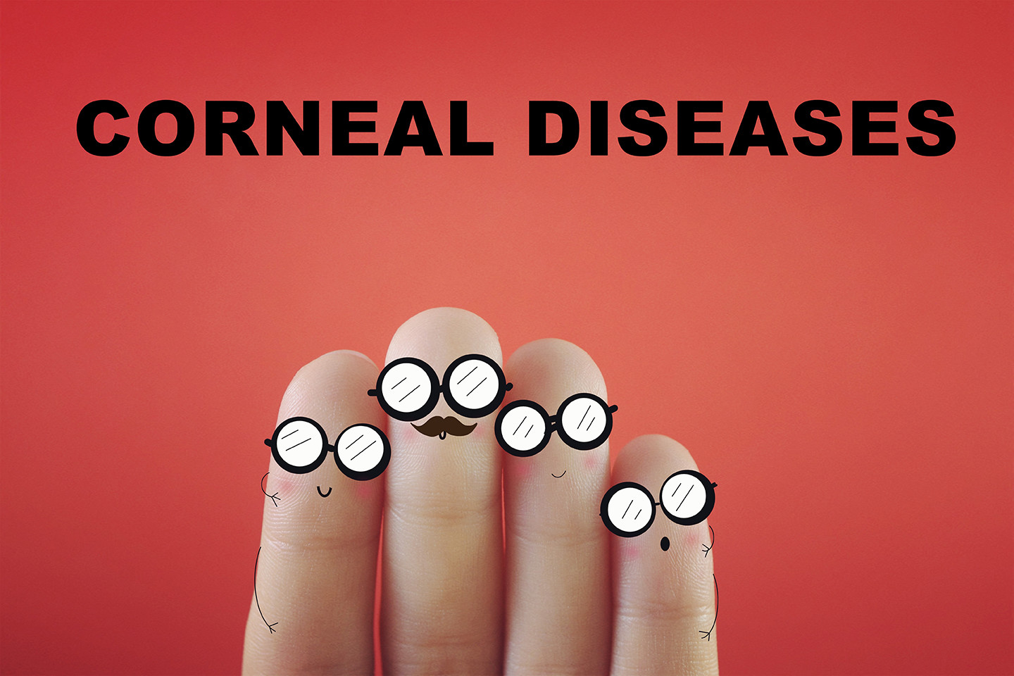 corneal diseases