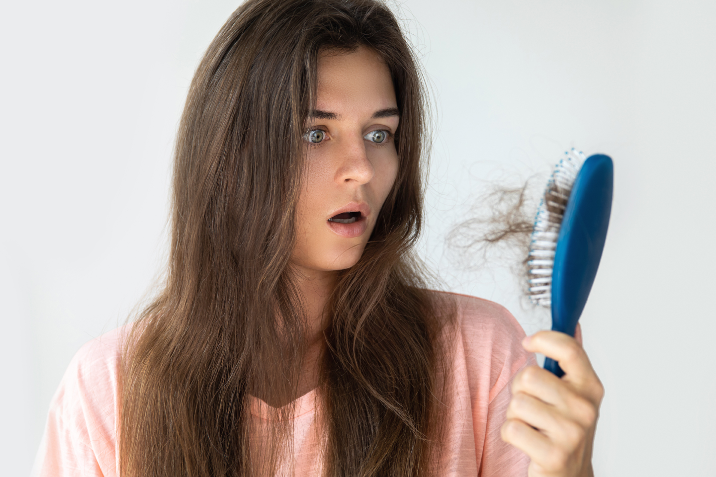 Excess Hair Growth or Loss due to PCOS
